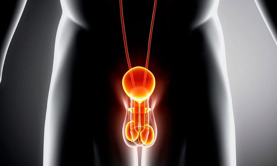 Geniturine enflammée pour la prostatite